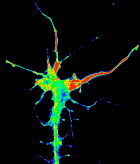 Polarised synthesis of beta-actin on the cue 'near-side' of growth cone. Gradient of Netrin-1 on right side triggers rapid synthesis (5 mins) of new beta-actin (red). Kimmy Leung.